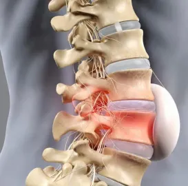 ფიზიოთერაპიული მკურნალობა